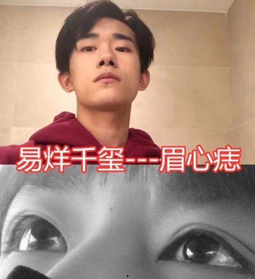 印堂有痣的明星